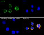 STING Antibody in Immunocytochemistry (ICC/IF)