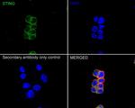 STING Antibody in Immunocytochemistry (ICC/IF)