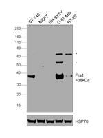 Fra1 Recombinant Rabbit Monoclonal Antibody (PSH06-95)