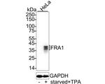 Fra1 Antibody in Western Blot (WB)