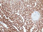 DOG-1 Antibody in Immunohistochemistry (Paraffin) (IHC (P))