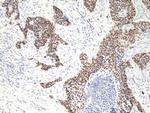p40 (DeltaNp63) Recombinant Rabbit Monoclonal Antibody (RM392)