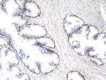 p40 (DeltaNp63) Antibody in Immunohistochemistry (Paraffin) (IHC (P))