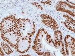 CDX2 Antibody in Immunohistochemistry (Paraffin) (IHC (P))