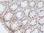 CDX2 Antibody in Immunohistochemistry (Paraffin) (IHC (P))