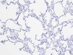 Claudin 18.2 Antibody in Immunohistochemistry (Paraffin) (IHC (P))