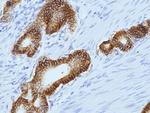 Claudin 18.2 Antibody in Immunohistochemistry (Paraffin) (IHC (P))