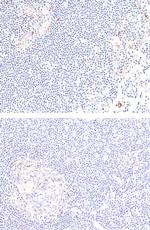 CD137 Recombinant Rabbit Monoclonal Antibody (RM471)