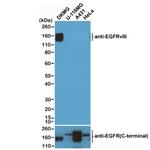 EGFRvIII Antibody in Western Blot (WB)