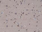 LC3B Antibody in Immunohistochemistry (Paraffin) (IHC (P))