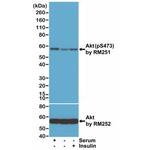 Phospho-AKT Pan (Ser473) Antibody in Western Blot (WB)