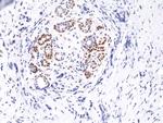 Phospho-STAT3 (Tyr705) Antibody in Immunohistochemistry (Paraffin) (IHC (P))