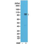 Phospho-STAT3 (Tyr705) Antibody in Western Blot (WB)