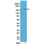 Phospho-EGFR (Tyr1173) Antibody in Western Blot (WB)