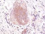 Phospho-EIF2S1 (Ser51) Antibody in Immunohistochemistry (Paraffin) (IHC (P))