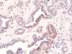 Phospho-EIF2S1 (Ser51) Recombinant Rabbit Monoclonal Antibody (RM298)