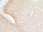 Phospho-Tau (Ser396) Antibody in Immunohistochemistry (Paraffin) (IHC (P))