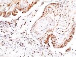 Phospho-JNK1/JNK2/JNK3 (Thr183, Tyr185) Recombinant Rabbit Monoclonal Antibody (RM464)