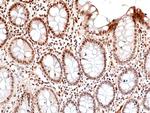 Phospho-JNK1/JNK2/JNK3 (Thr183, Tyr185) Antibody in Immunohistochemistry (Paraffin) (IHC (P))