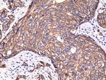 ErbB2 (HER-2) Antibody in Immunohistochemistry (Paraffin) (IHC (P))