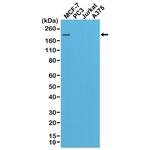 ErbB2 (HER-2) Antibody in Western Blot (WB)