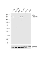 ErbB2 (HER-2) Antibody