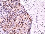 Cyclin D1 Antibody in Immunohistochemistry (Paraffin) (IHC (P))