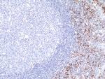 Cyclin D1 Antibody in Immunohistochemistry (Paraffin) (IHC (P))