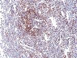 Cyclin D1 Recombinant Rabbit Monoclonal Antibody (RM241)