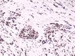 HIF1A Recombinant Rabbit Monoclonal Antibody (RM242)