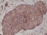E-cadherin Antibody in Immunohistochemistry (Paraffin) (IHC (P))