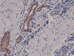 CD146 Antibody in Immunohistochemistry (Paraffin) (IHC (P))