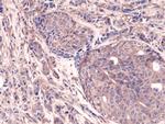 NFkB p65 Antibody in Immunohistochemistry (Paraffin) (IHC (P))