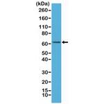 NFkB p65 Antibody in Western Blot (WB)