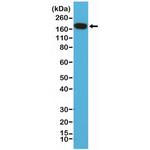 EGFR Antibody in Western Blot (WB)