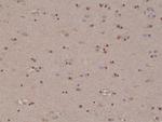 S100B Antibody in Immunohistochemistry (Paraffin) (IHC (P))