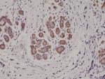 S100B Antibody in Immunohistochemistry (Paraffin) (IHC (P))