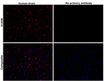 S100B Antibody in Immunohistochemistry (Paraffin) (IHC (P))