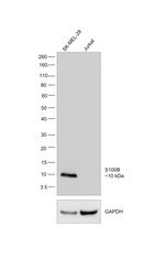 S100B Antibody in Western Blot (WB)
