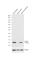 S100B Antibody in Western Blot (WB)