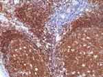 CD19 Antibody in Immunohistochemistry (Paraffin) (IHC (P))