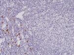 c-Kit Antibody in Immunohistochemistry (Paraffin) (IHC (P))