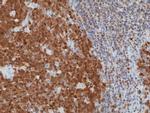 BOB-1 Recombinant Rabbit Monoclonal Antibody (RM378)