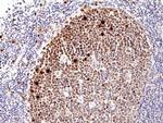 Ki-67 Antibody in Immunohistochemistry (Paraffin) (IHC (P))