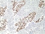 p53 Antibody in Immunohistochemistry (Paraffin) (IHC (P))