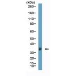 Apolipoprotein J Recombinant Rabbit Monoclonal Antibody (RM437)