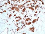 STAT3 Recombinant Rabbit Monoclonal Antibody (RM465)