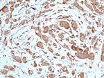 STAT3 Antibody in Immunohistochemistry (Paraffin) (IHC (P))