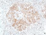 STAT3 Antibody in Immunohistochemistry (Paraffin) (IHC (P))