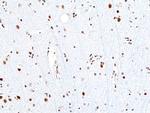 SMARCB1 Antibody in Immunohistochemistry (Paraffin) (IHC (P))